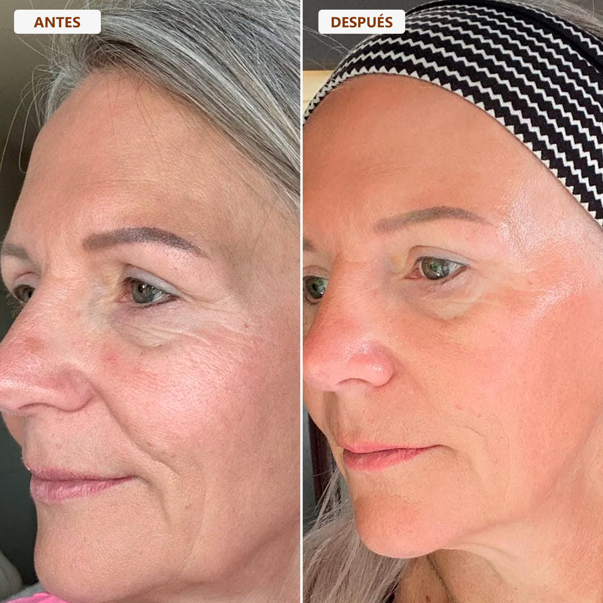 Brocha Facial para Contorno Linfático