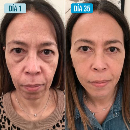 Serum Ultra Hidratante-Reparador con 3% de Ácido Hialurónico