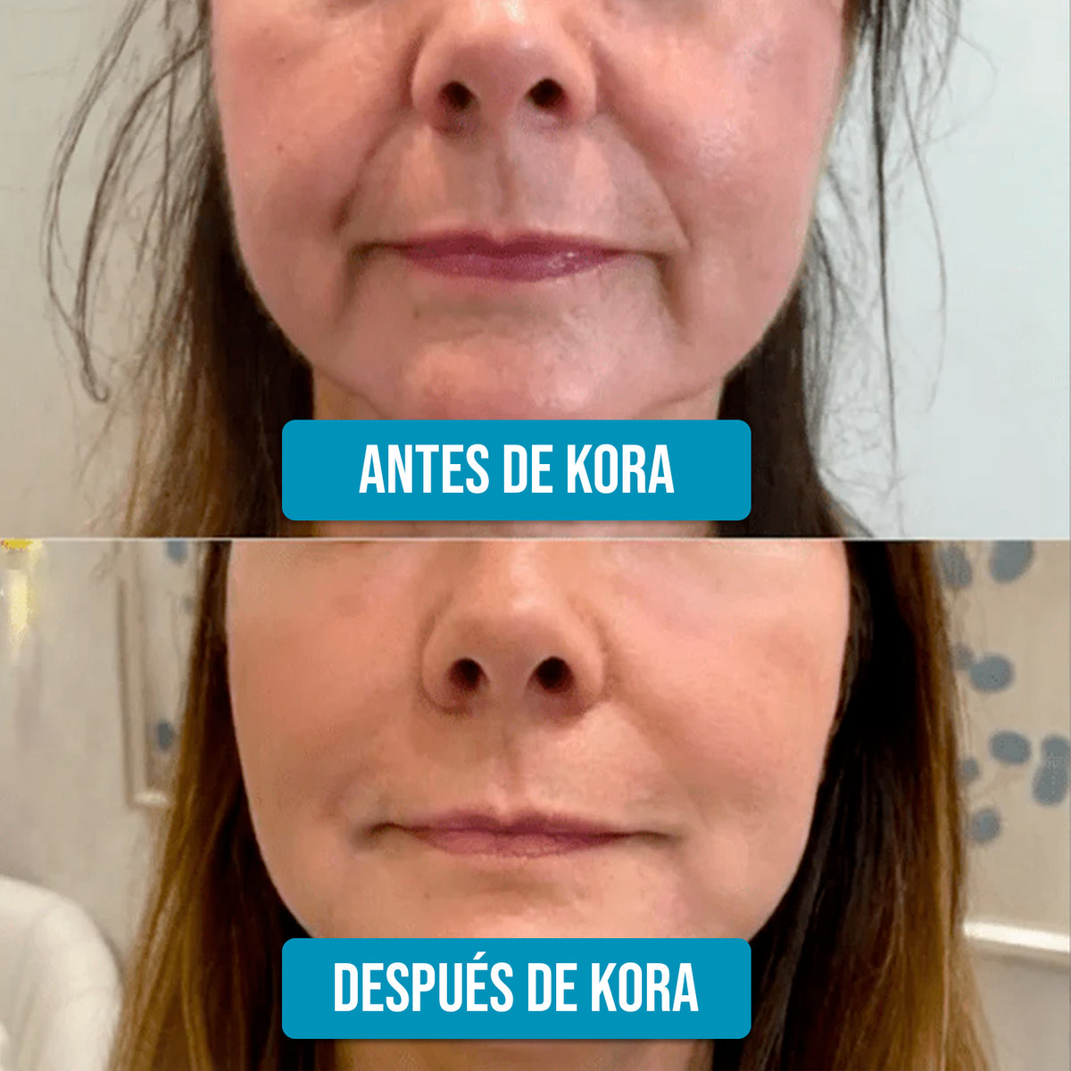 Serum Ultra Hidratante-Reparador con 3% de Ácido Hialurónico