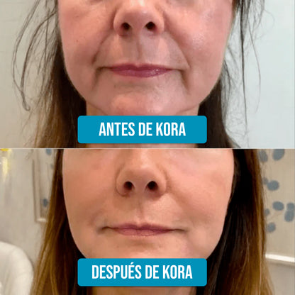 Serum Ultra Hidratante-Reparador con 3% de Ácido Hialurónico