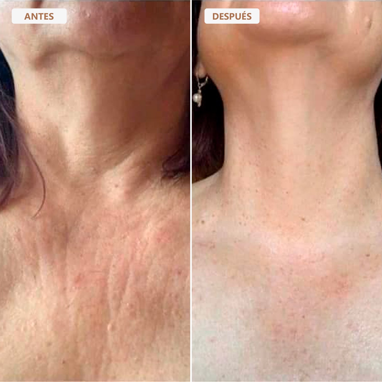Aceite Corporal Besque™