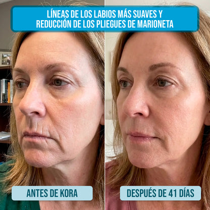 Serum Ultra Hidratante-Reparador con 3% de Ácido Hialurónico